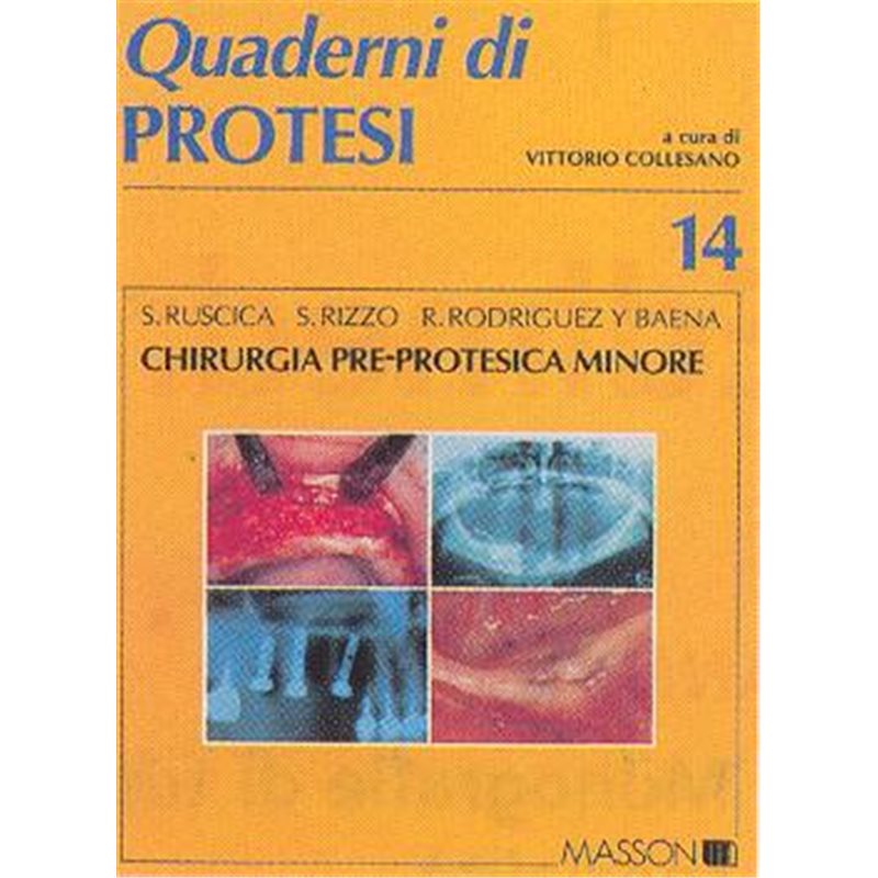 Quaderni di Protesi - 14 - Chirurgia pre-protesica minore